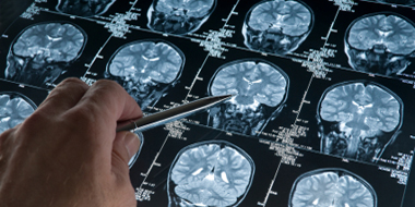 iStock MRI review